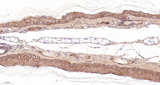 Caspase 14 Antibody in Immunohistochemistry (Paraffin) (IHC (P))