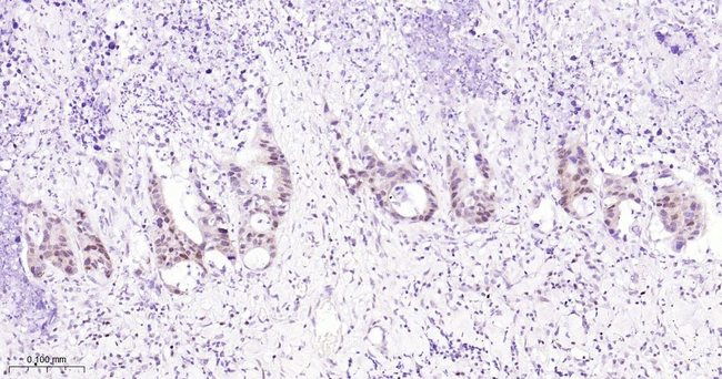 MGMT Antibody in Immunohistochemistry (Paraffin) (IHC (P))
