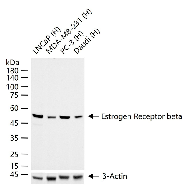 Estrogen Receptor beta Antibody in Western Blot (WB)
