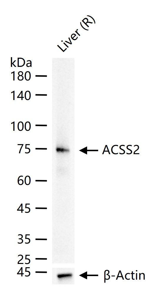 ACSS2 Antibody in Western Blot (WB)