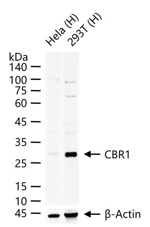 CBR1 Antibody in Western Blot (WB)