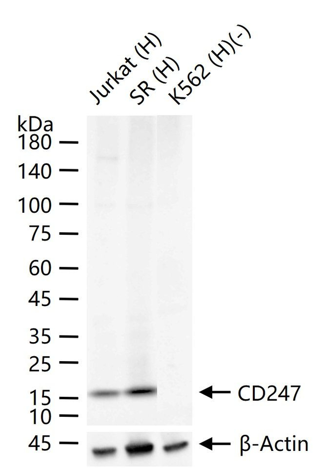 CD3 zeta Antibody in Western Blot (WB)