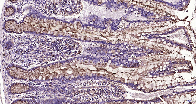 LAMP1 Antibody in Immunohistochemistry (Paraffin) (IHC (P))