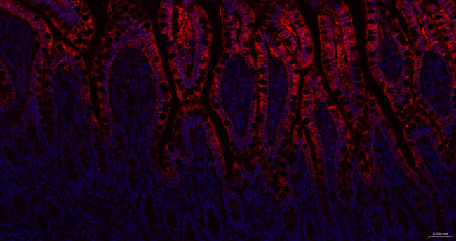 EBP50 Antibody in Immunohistochemistry (Paraffin) (IHC (P))