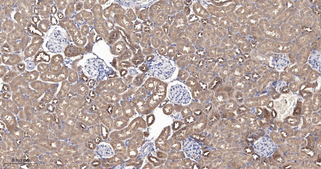 IDE Antibody in Immunohistochemistry (Paraffin) (IHC (P))