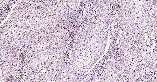 SP1 Antibody in Immunohistochemistry (Paraffin) (IHC (P))