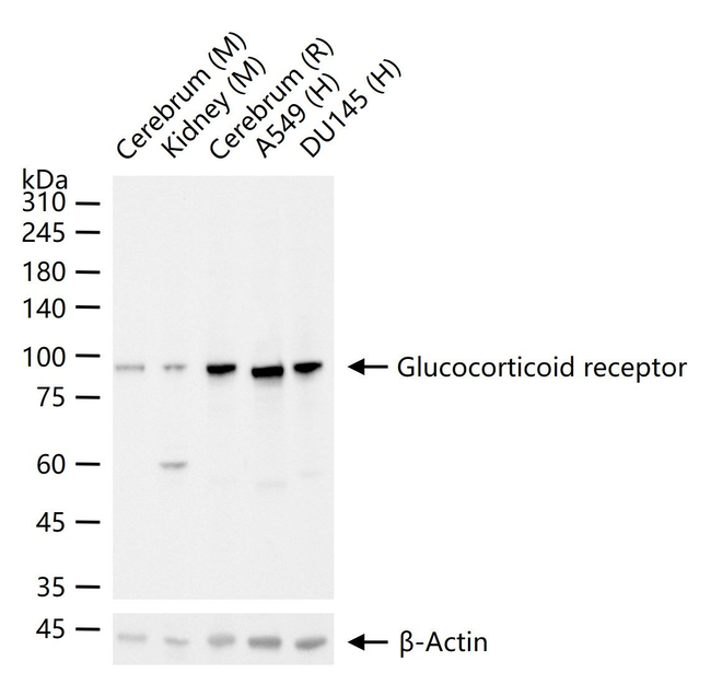 Glucocorticoid receptor Antibody in Western Blot (WB)