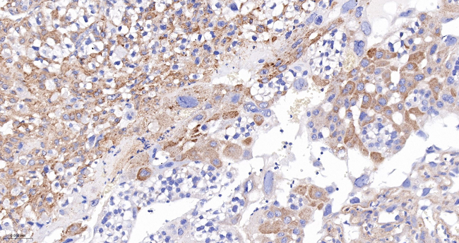 VAMP8 Antibody in Immunohistochemistry (Paraffin) (IHC (P))