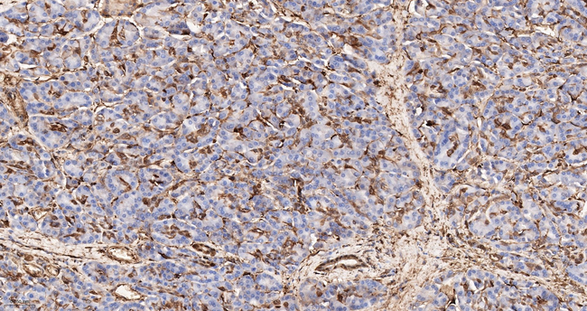 S100A6 Antibody in Immunohistochemistry (Paraffin) (IHC (P))