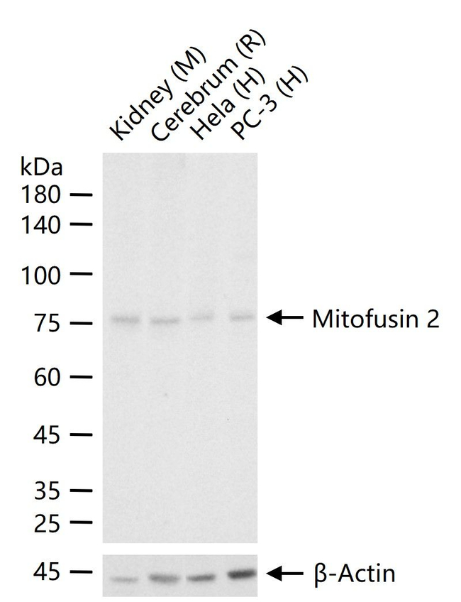 MFN2 Antibody in Western Blot (WB)
