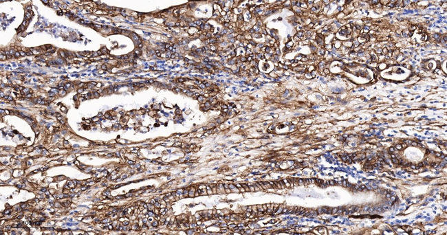 S100A10 Antibody in Immunohistochemistry (Paraffin) (IHC (P))