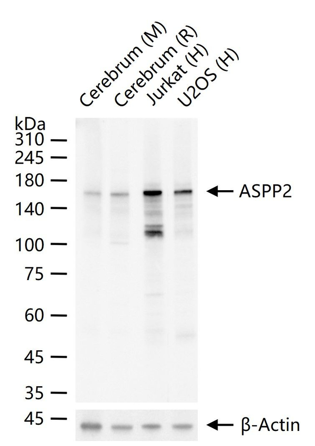 53BP2 Antibody in Western Blot (WB)