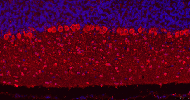 Parvalbumin Antibody in Immunohistochemistry (Paraffin) (IHC (P))