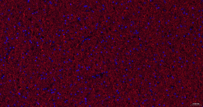 CNPase Antibody in Immunohistochemistry (Paraffin) (IHC (P))
