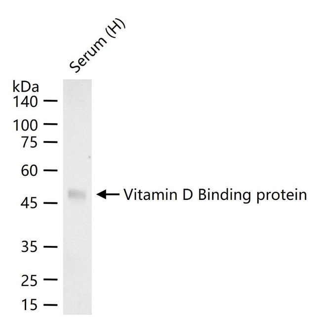 GC Antibody in Western Blot (WB)