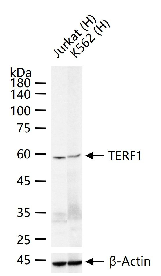 TRF1 Antibody in Western Blot (WB)
