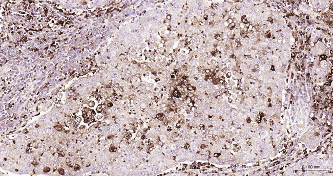 CEACAM5 Antibody in Immunohistochemistry (Paraffin) (IHC (P))