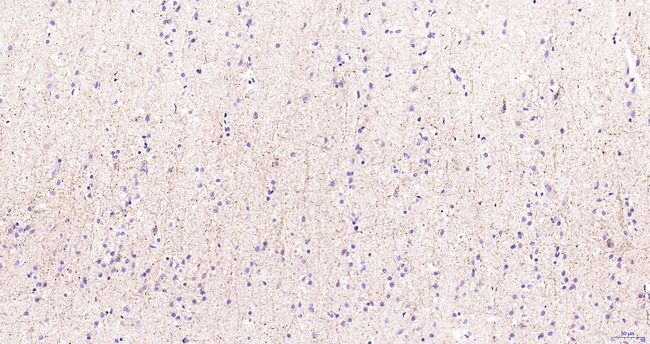 TAC1 Antibody in Immunohistochemistry (Paraffin) (IHC (P))