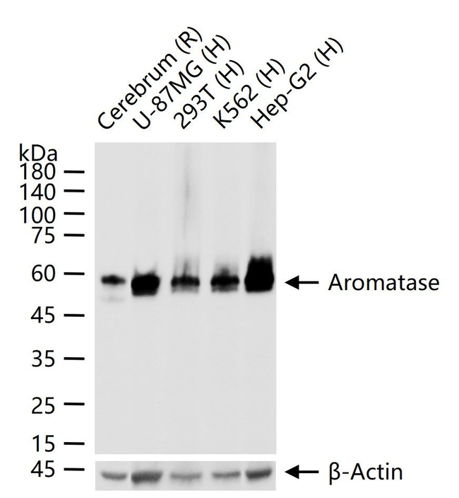 Aromatase Antibody in Western Blot (WB)