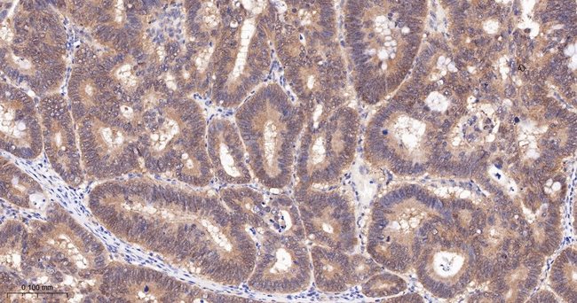 Cyclophilin A Antibody in Immunohistochemistry (Paraffin) (IHC (P))