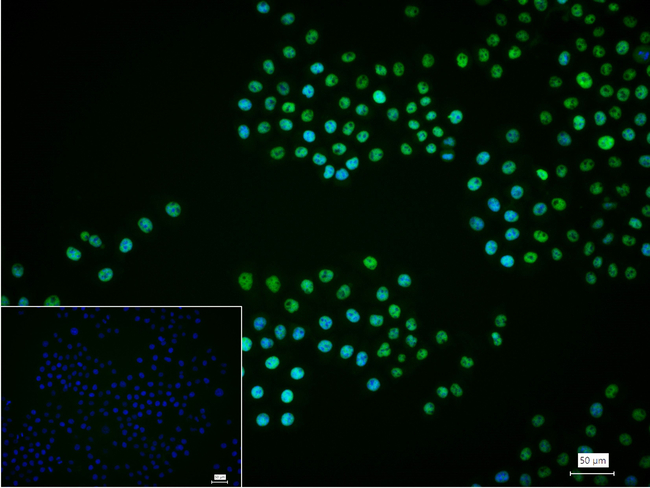 SMC3 Antibody in Immunocytochemistry (ICC/IF)
