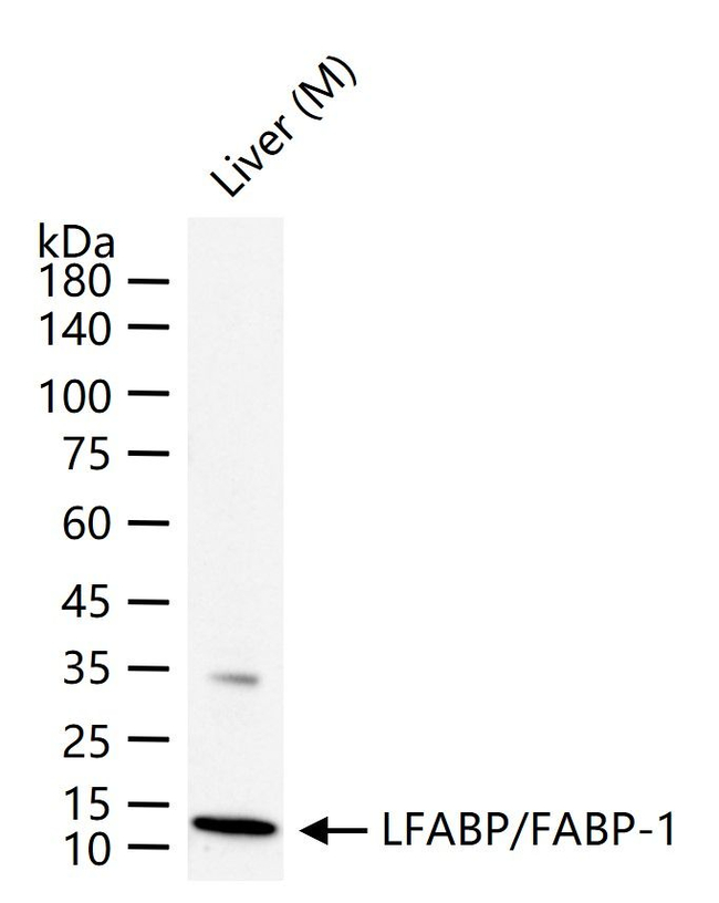 FABP1 Antibody in Western Blot (WB)