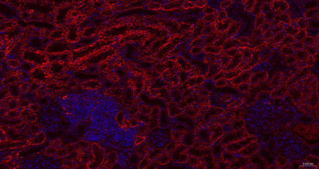 Cathepsin H/K/L/V Antibody in Immunohistochemistry (Paraffin) (IHC (P))