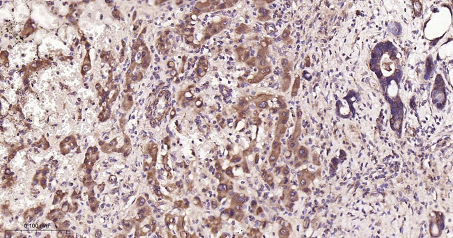 SDHA Antibody in Immunohistochemistry (Paraffin) (IHC (P))