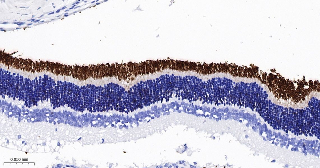 Rhodopsin Antibody in Immunohistochemistry (Paraffin) (IHC (P))