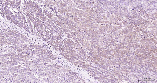 BNIP3 Antibody in Immunohistochemistry (Paraffin) (IHC (P))