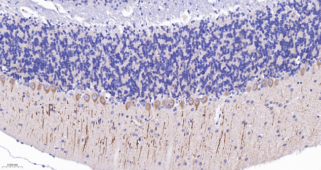 DCLK1 Antibody in Immunohistochemistry (Paraffin) (IHC (P))