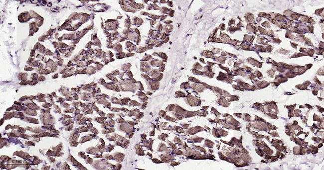 ATP5A1 Antibody in Immunohistochemistry (Paraffin) (IHC (P))