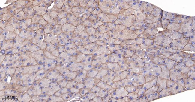 CD104 Antibody in Immunohistochemistry (Paraffin) (IHC (P))