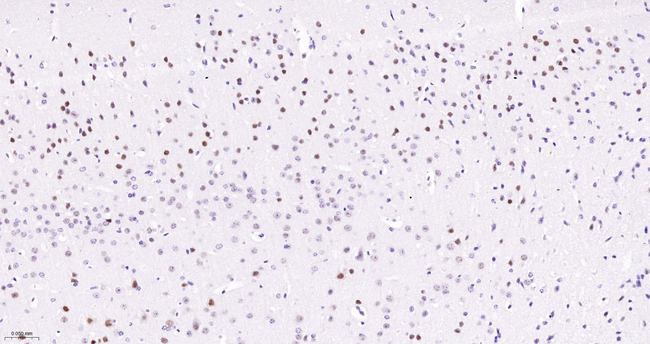 Cyclin H Antibody in Immunohistochemistry (Paraffin) (IHC (P))