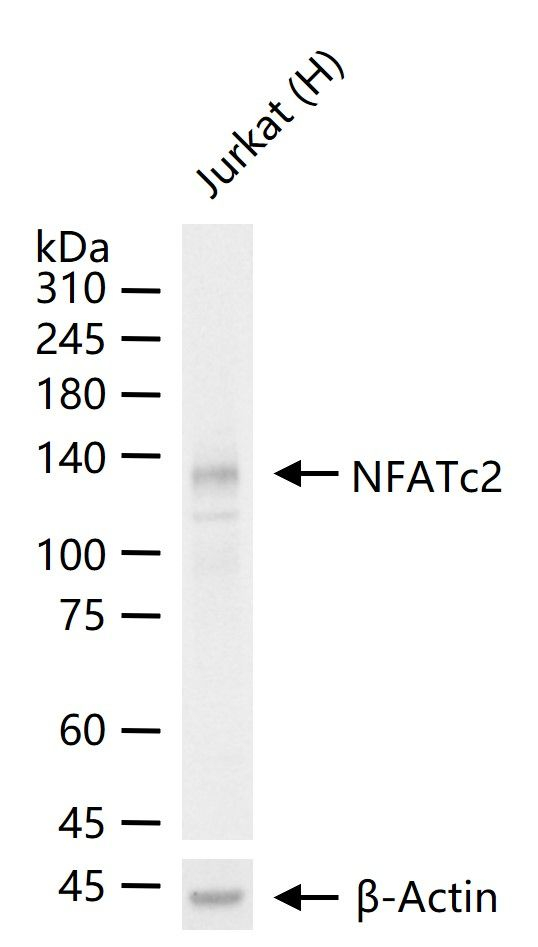 NFATC2 Antibody in Western Blot (WB)
