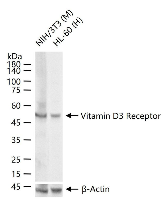 VDR Antibody in Western Blot (WB)