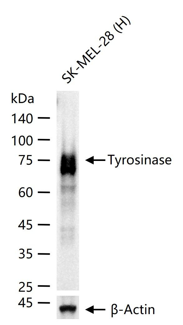 Tyrosinase Antibody in Western Blot (WB)