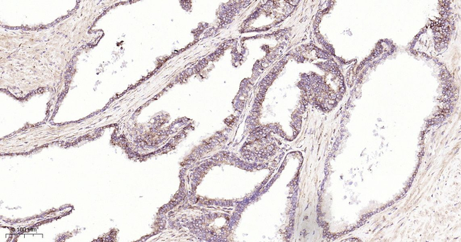 GRP94 Antibody in Immunohistochemistry (Paraffin) (IHC (P))