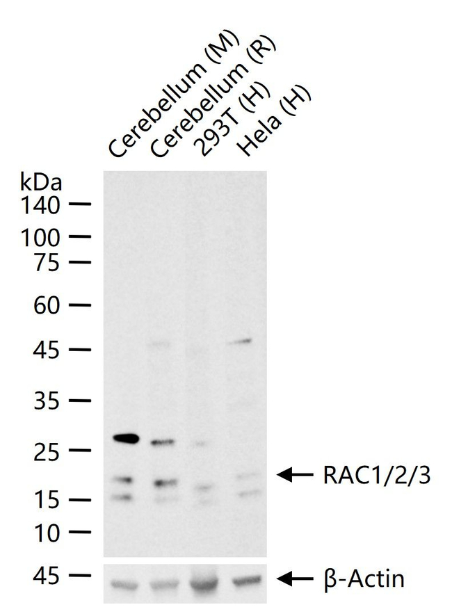 RAC1/RAC2/RAC3 Antibody in Western Blot (WB)