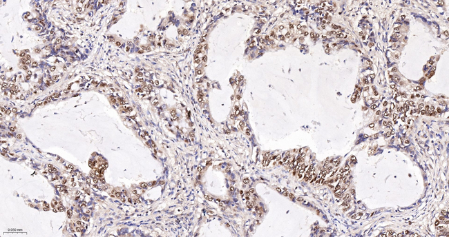 Ku70 Antibody in Immunohistochemistry (Paraffin) (IHC (P))