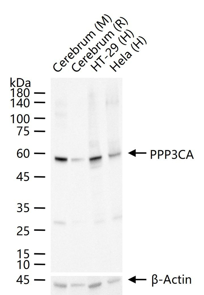 Calcineurin A Antibody in Western Blot (WB)