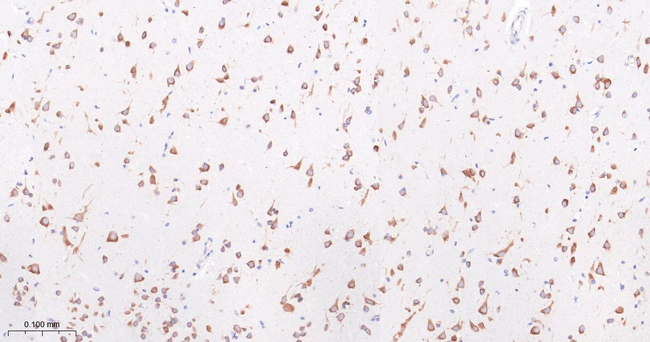 FMRP Antibody in Immunohistochemistry (Paraffin) (IHC (P))