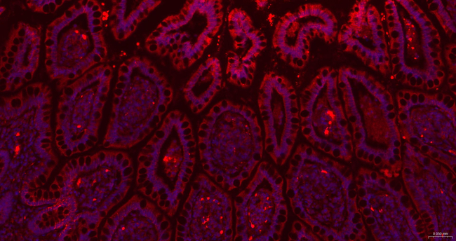 SAA Antibody in Immunohistochemistry (Paraffin) (IHC (P))