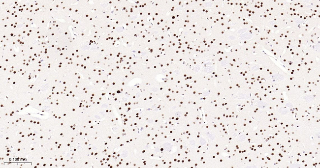 53BP1 Antibody in Immunohistochemistry (Paraffin) (IHC (P))