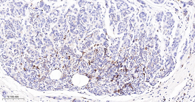 SFRP1 Antibody in Immunohistochemistry (Paraffin) (IHC (P))