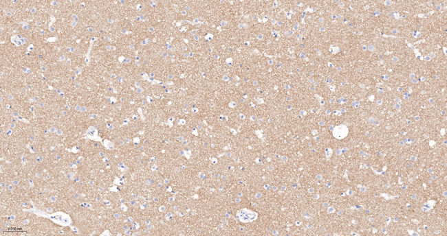 PRKAR2B Antibody in Immunohistochemistry (Paraffin) (IHC (P))
