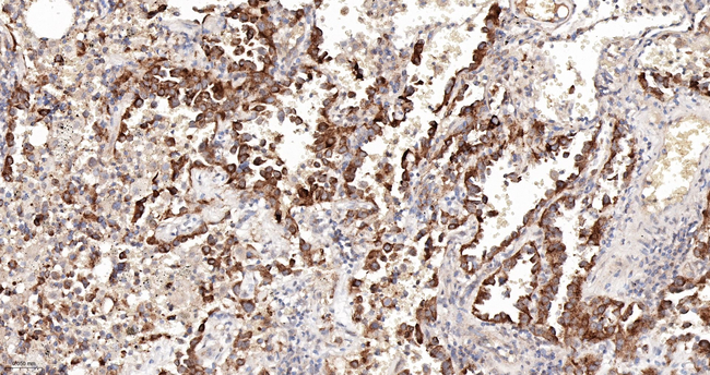 SOS1 Antibody in Immunohistochemistry (Paraffin) (IHC (P))