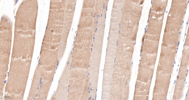 CaMKII delta Antibody in Immunohistochemistry (Paraffin) (IHC (P))