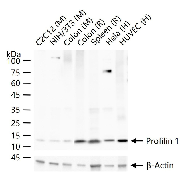 Profilin 1 Antibody in Western Blot (WB)