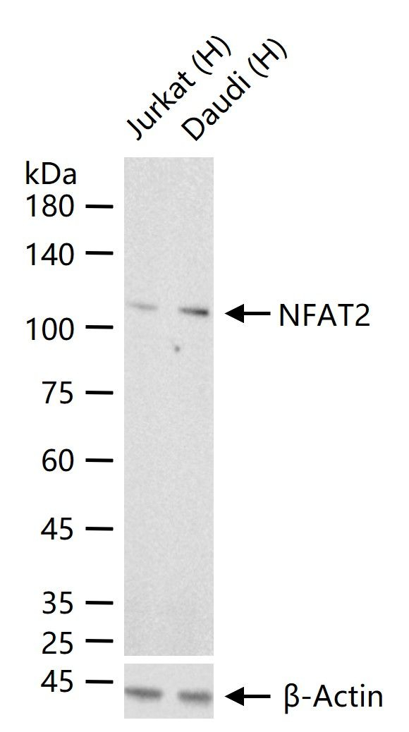 NFATC1 Antibody in Western Blot (WB)